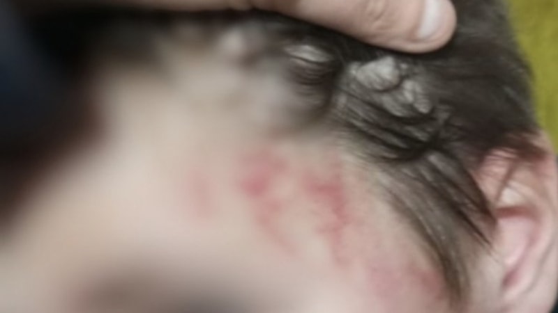 Muğla'da otizmli çocuğunu darbettiği iddia edilen babaya hapis cezası