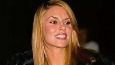 Brandi Glanville'in yüzü eriyor! Suratında mantar ve parazit oluştu