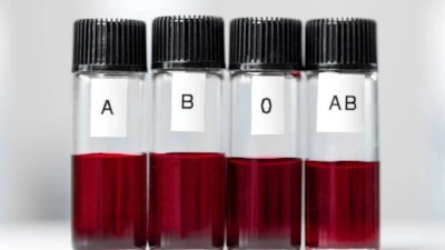 Bu kan grubundaysanız dikkat: Unutkanlık en çok o kan grubunun kapısını çalıyor!