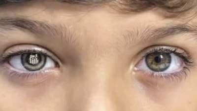 Brezilya'da Santoslu minik taraftar gözünü kaybedince yerine kulüp armasını taktırdı