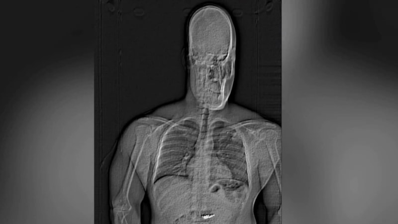 ABD'de ilginç hırsızlık: 769 bin dolarlık küpeleri çaldıktan sonra yuttu