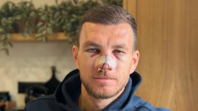 Edin Dzeko'nun son durumu belli oldu
