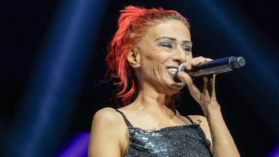 Yüzü yanan Yıldız Tilbe'den yeni tarz