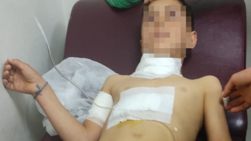 Diyarbakır'da 10 yaşındaki çocuğa köpek saldırdı