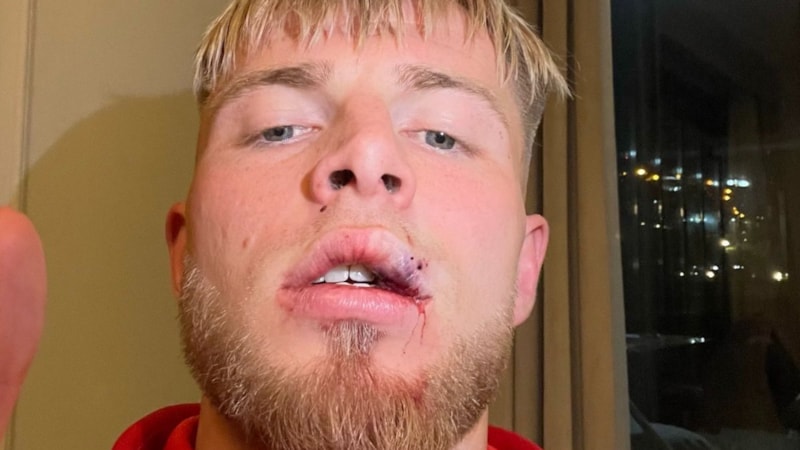 Samsunspor'da Rick van Drongelen'in dudağına dikiş atıldı