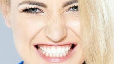 Diş sıkmanın uykuya ve sağlığa zararları