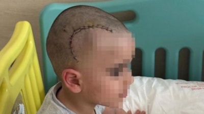 Kadıköy'de anaokulunda kaydıraktan düşen çocuk, ölümden döndü