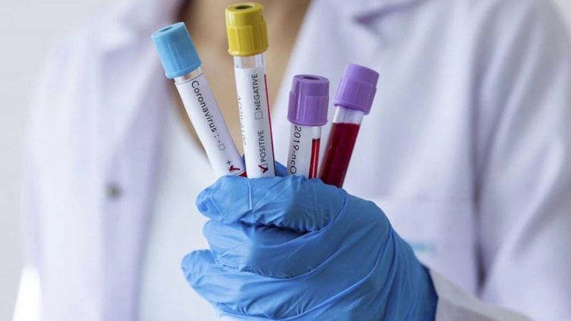 Senegal'de eski bakanlara koronavirüs soruşturması