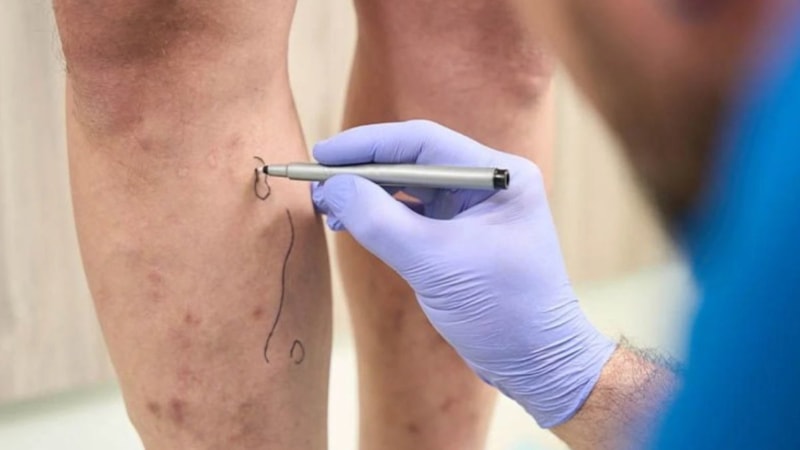 Varise ne iyi gelir? Varis nasıl geçer?