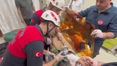 Şanlıurfa'da işçinin koluna demir şiş saplandı