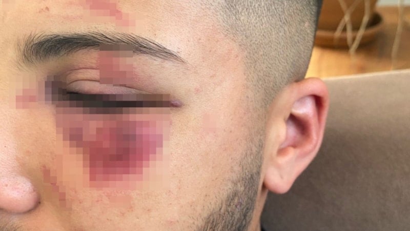 Yalova'da 4 kişi tarafından defalarca bıçaklandı