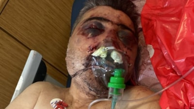 İngiliz boksörün taksiciyi dövdüğü anlara ait kamera kaydı ortaya çıktı