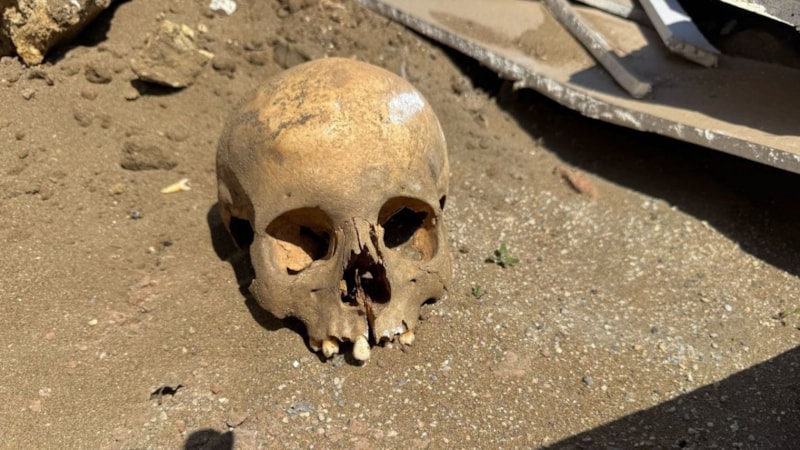 Sakarya'da inşaat işçilerinin bulduğu kafatası ekipleri harekete geçirdi