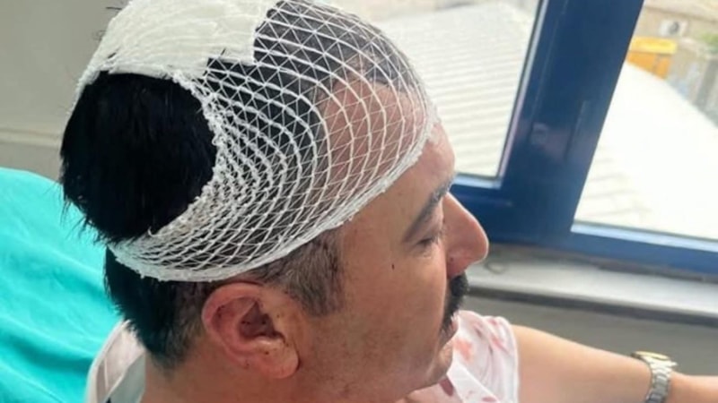 Kahramanmaraş'ta belediye başkanı yardımcısına 'şekerlikli' saldırı