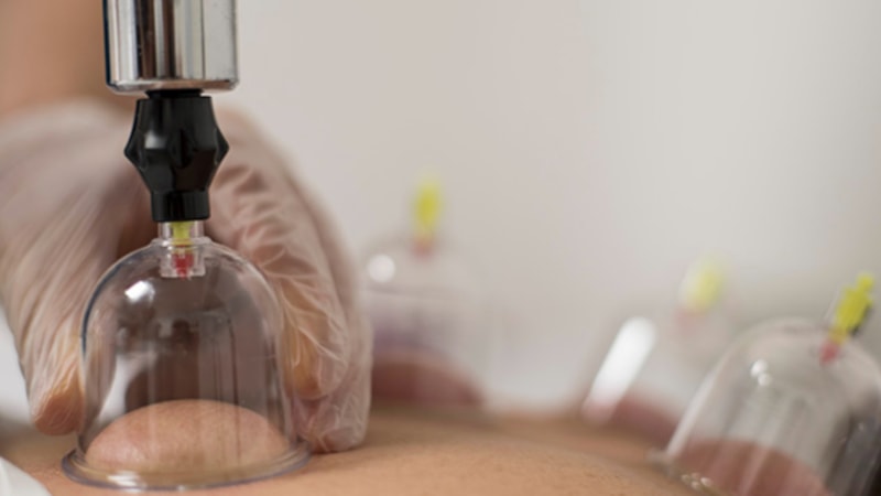 Sünnetli hacamat takvimi 2025: Mayıs'ta uygun olan günler