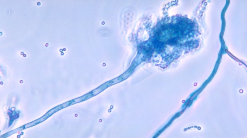 Küresel ısınmayla ölümcül mantar hastalığı yayılabilir