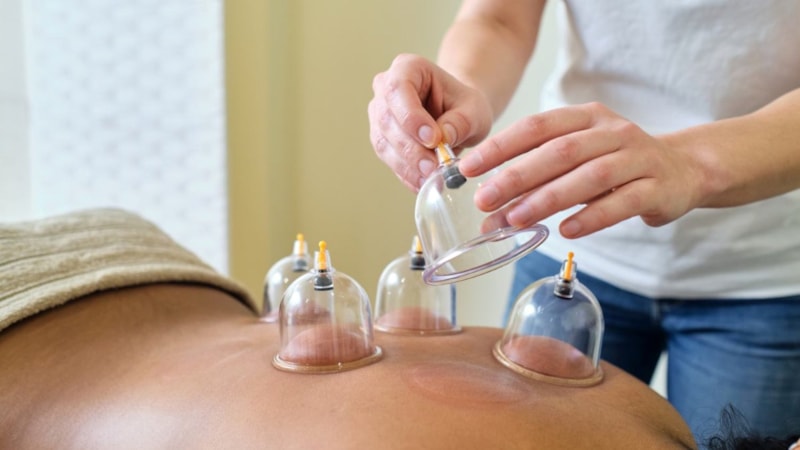 Hacamat hangi sıklıkla yapılır? 2 hacamat arası kaç gün olmalı?