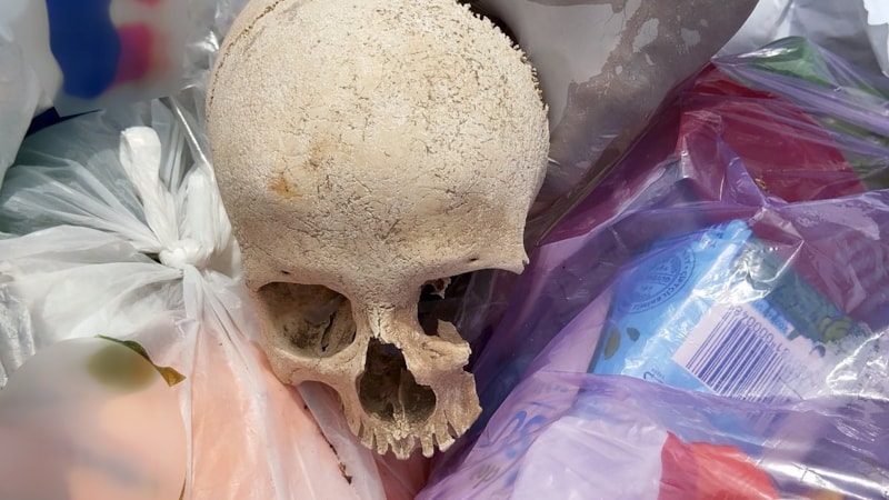 Adana'da çöpten insana ait kafatası çıktı