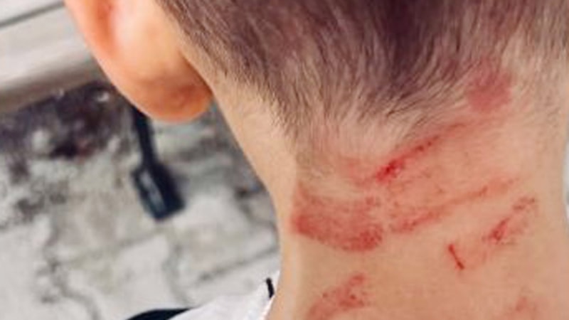 Burdur’da özel gereksinimli çocuğa darp: Soruşturma açıldı