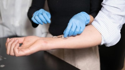 Enfeksiyonu günler öncesinden tespit eden akıllı bandaj çıktı