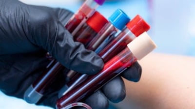 En halsiz kan grubu belli oldu: Gün ortasında pilleri bitiyor…