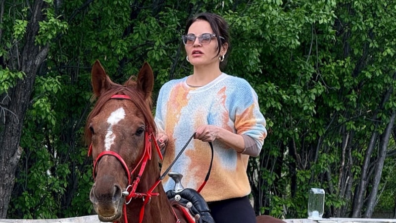 Estetik iddiaları vardı! Göksel sosyal medyadan açıklama yaptı