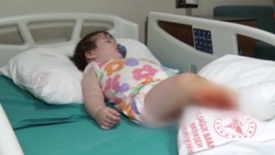 İstanbul'da üzerine çaydanlık devrilen 1 yaşındaki bebek dehşeti yaşadı