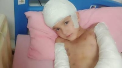 Ankara'da sokak köpeklerinin saldırdığı Tunahan davasında beraat gerekçesi açıklandı