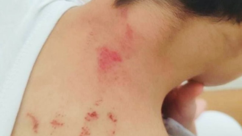 Şanlıurfa'da öğrencisini darbeden öğretmene tutuklama