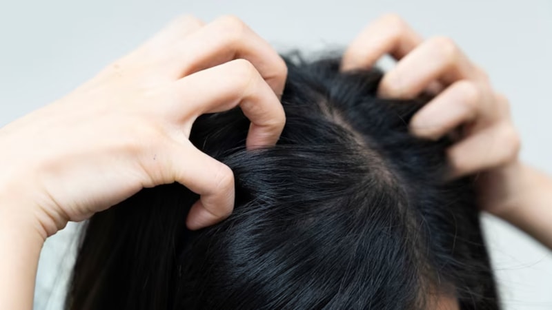 Saç dibinize tarçın dökün, etkisini hemen görün...