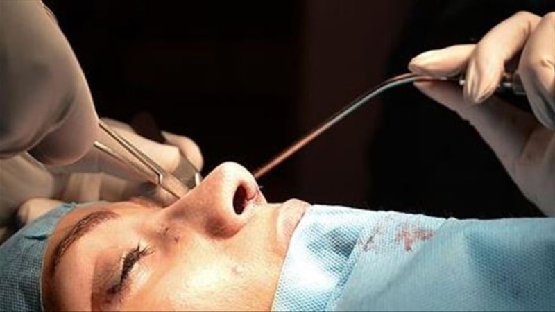 Estetik artık gençlerin tercihi: Yaş 18'in altına indi