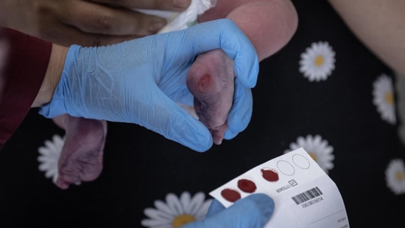 Türkiye'de her 25 kişiden biri fenilketonüri taşıyıcısı