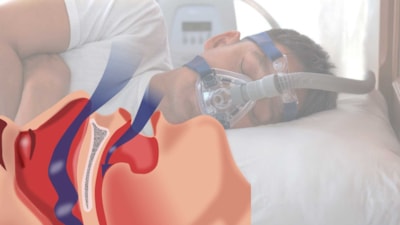 Uzmanlardan bayram dönüş yolunda 'uyku apnesi' uyarısı