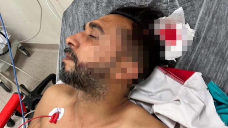 Adana'da döner ustası çalışırken başına yorgun mermi düştü