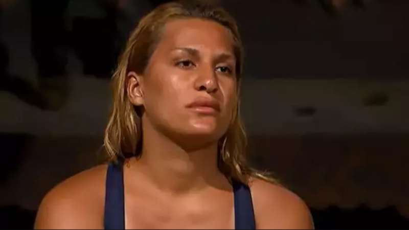 Survivor sonrası estetik yaptırdı! Almeda Baylan'ın son pozları olay oldu