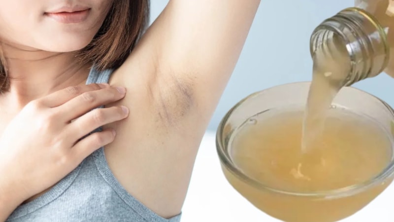 Ne deodorant, ne de parfüm… Koltuk altına sürün, yaz boyu rahat edin