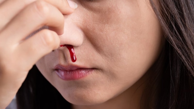 Ani burun kanamaları neyin habercisi? İşte en yaygın sebepler