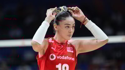 Zehra Güneş'in maç sırasında gözlük takmasının sebebi belli oldu