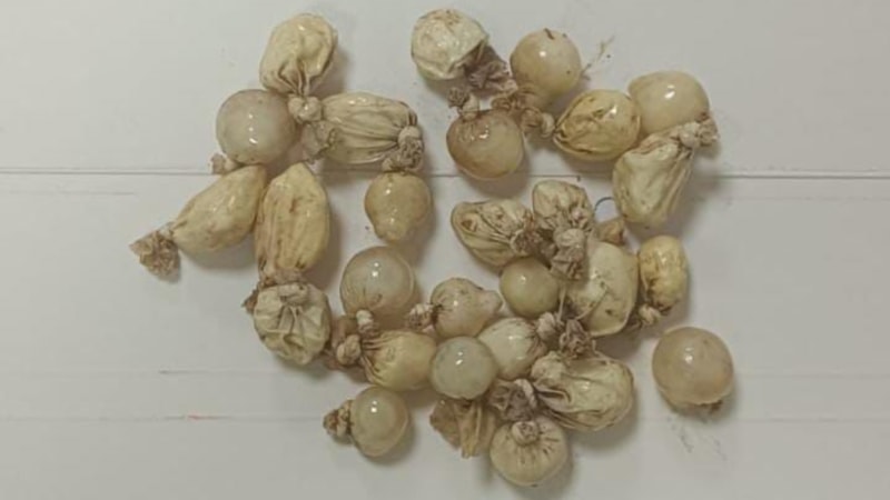 Kocaeli'de alkollü sanılan sürücünün midesinden kokain çıktı