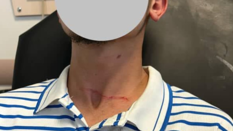 Kastamonu'da motosikletli kurye başıboş köpeğin saldırısına uğradı