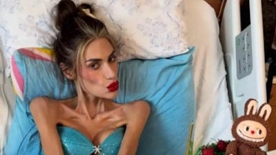 23 kiloya kadar düşen Nihal Candan yaşamını yitirdi