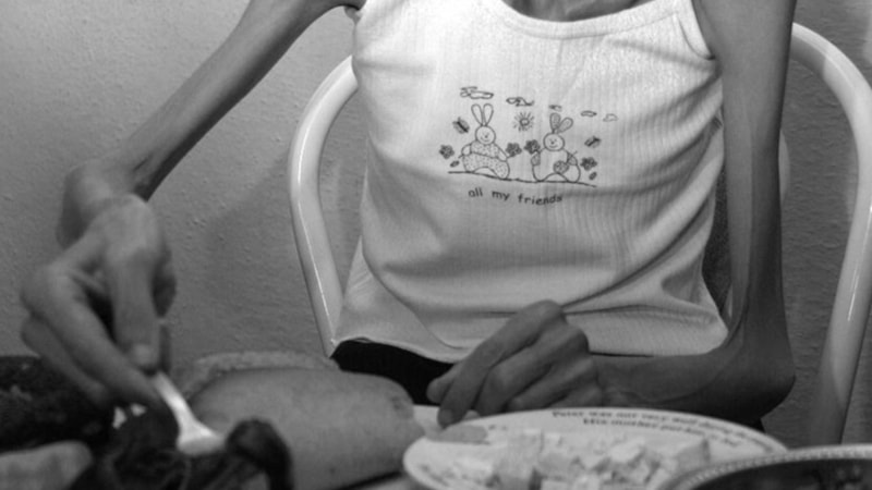 Anoreksiya nervoza: Gençleri tehdit eden sessiz hastalık