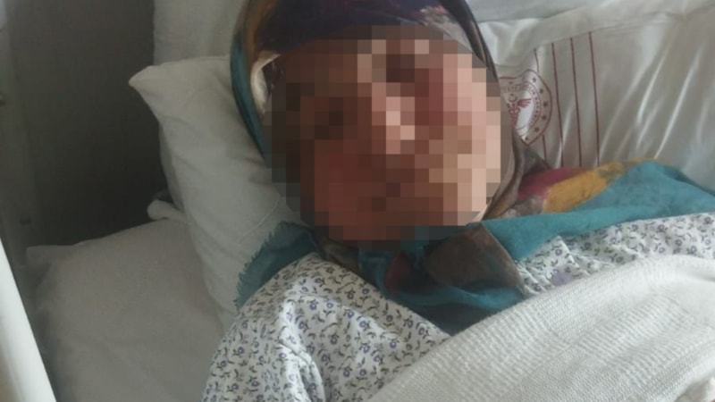 Ankara'da yorgun mermi isabet eden yaşlı kadın yaralandı