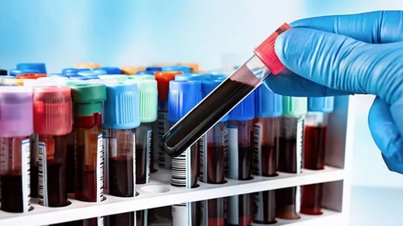 Dünyada yalnızca bir kişide görüldü! İşte, yeni kan grubu