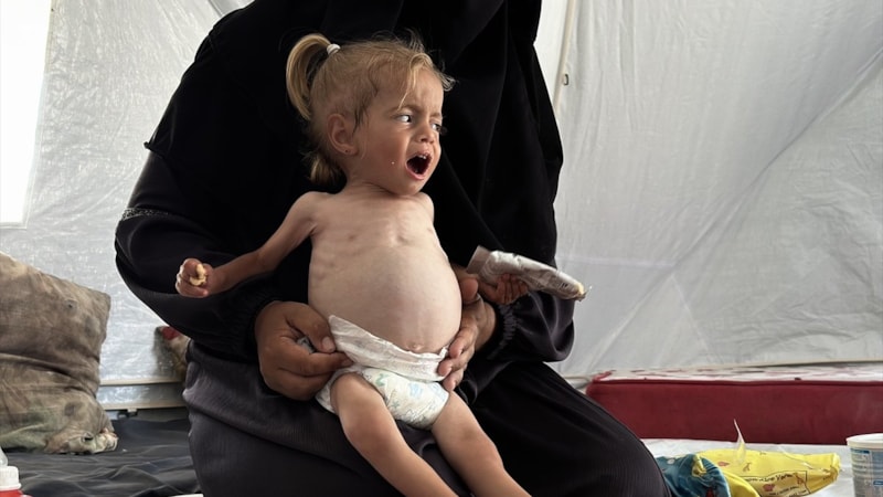 Gazze'de 2 yaşındaki Filistinli bebek yaşam mücadelesi veriyor