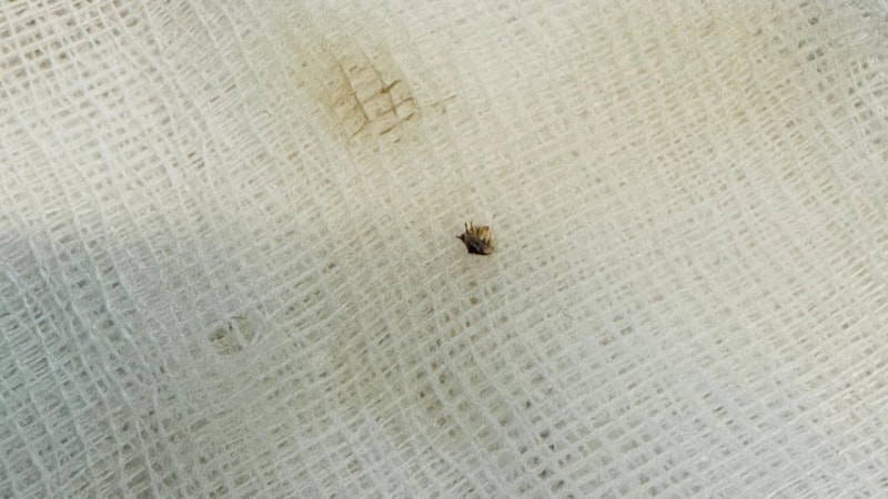 Kahramanmaraş'ta halsizlik nedeniyle hastaneye gitti: Karnına yapışan kene bulundu