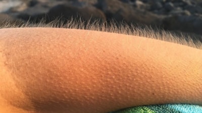 Tüylerin diken diken olmasının nedeni bakın neymiş…