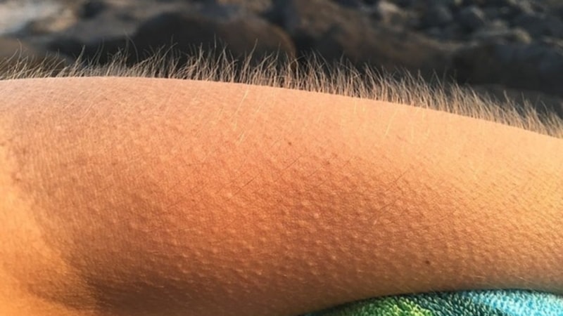 Tüylerin diken diken olmasının nedeni bakın neymiş…