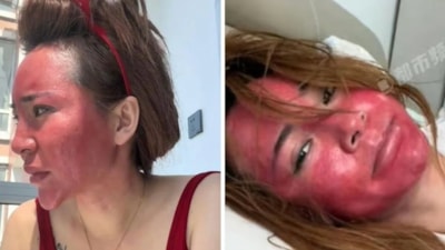 Çin'de yıllarca makyajını silmeden uyuyan kadın sağlığından oldu