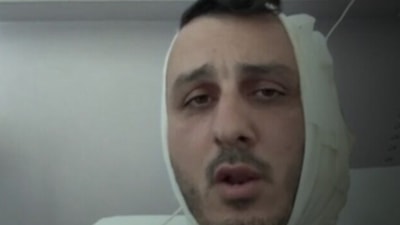 Yunanistan'a tatile giden İsrailli'ye saldırı: Kulağını kopardı